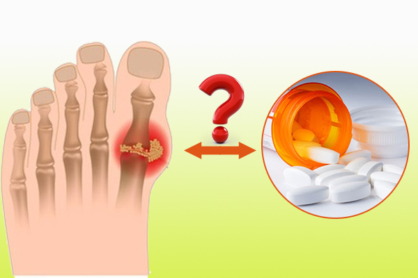 Corticoid - “Con dao 2 lưỡi” trong điều trị bệnh gút!
