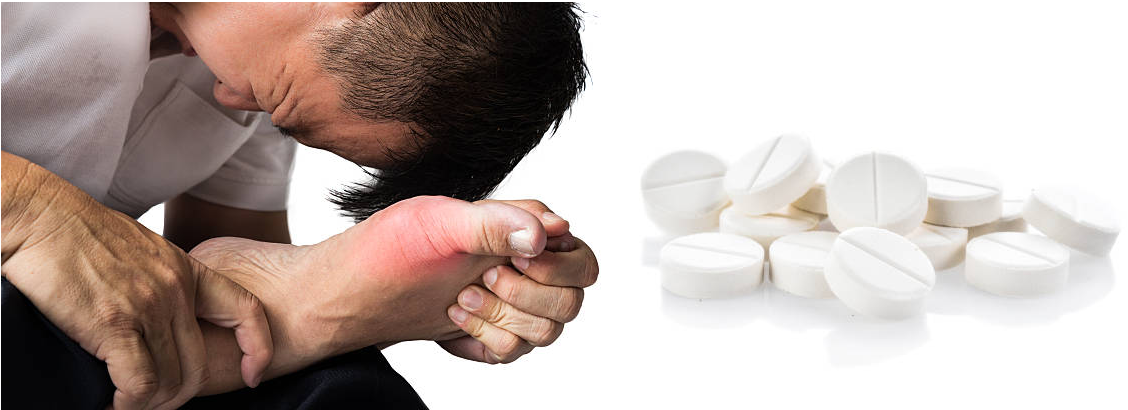 Dùng corticoid trong điều trị bệnh gút lợi hay hại?
