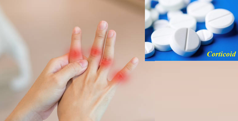 Corticoid giúp giảm đau nhanh chóng trong cơn gút cấp
