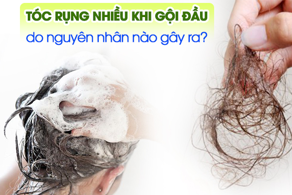 Tóc rụng nhiều khi gội đầu do nguyên nhân nào gây ra?