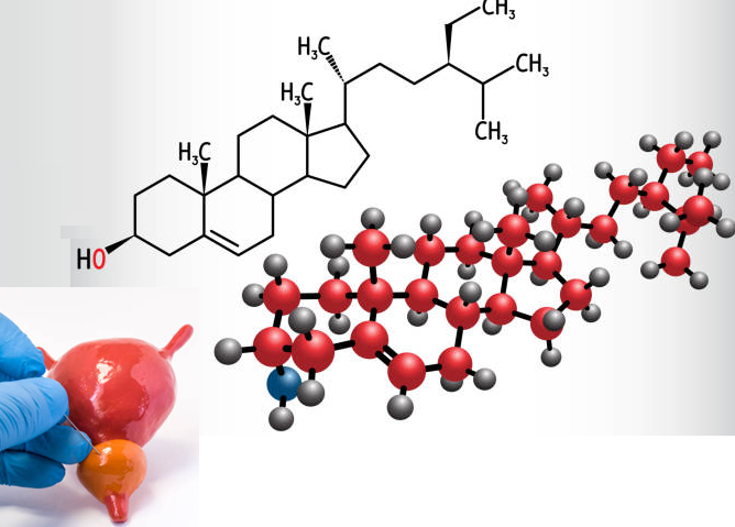 Phytosterol: Khắc tinh từ thiên nhiên của bệnh phì đại tiền liệt tuyến