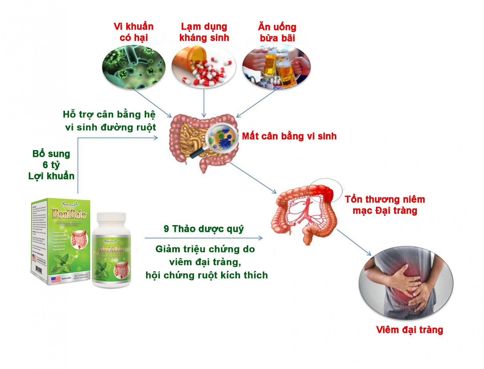 Cơ chế tác dụng của BoniBaio + với bệnh viêm đại tràng