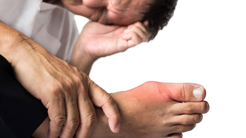 Người bị bệnh gút có uống glucosamin được không?