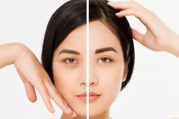 Vitamin C có tác dụng làm giảm quầng thâm mắt.