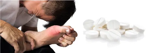 Dùng corticoid trong điều trị bệnh gút lợi hay hại?