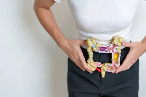 Viêm đại tràng mãn tính thường gây nhiều triệu chứng khác nhau