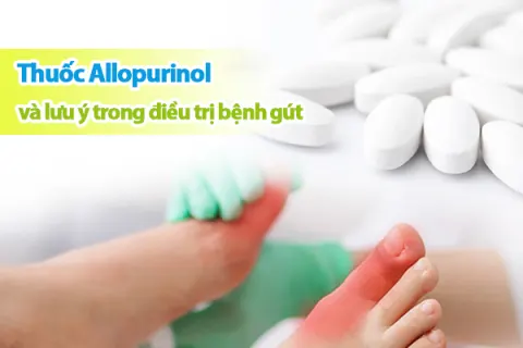 Những lưu ý khi sử dụng thuốc tây trong điều trị bệnh gút
