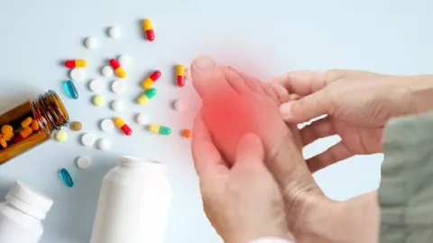 Cái giá phải trả khi dùng thuốc giảm đau gút cấp “vô tội vạ”