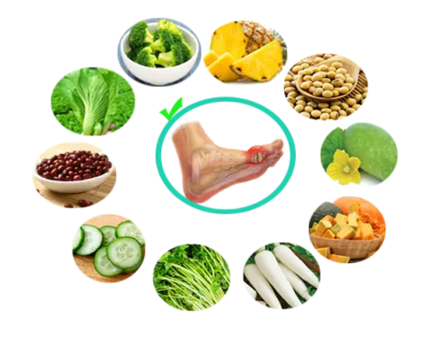 Tăng cường bổ sung rau xanh cho người bệnh gút