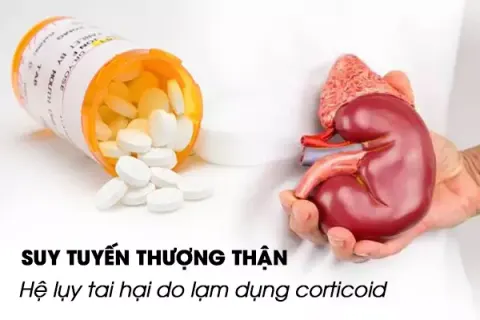 Suy tuyến thượng thận - Hệ lụy tai hại do lạm dụng corticoid