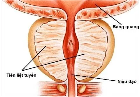 Phương pháp mới loại bỏ ung thư tuyến tiền liệt chỉ trong 1 giờ