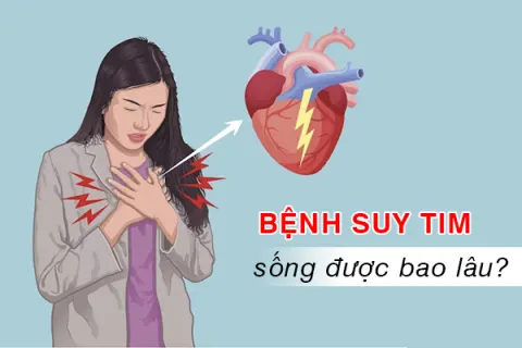 Mắc bệnh suy tim sống được bao lâu?