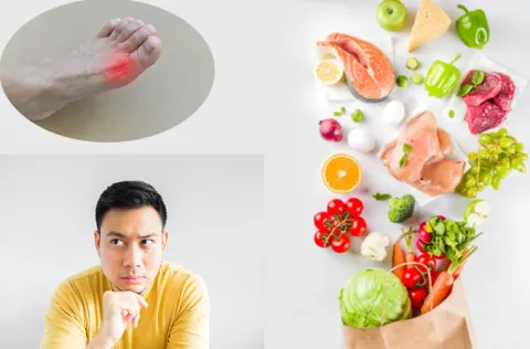 Bệnh gút ăn gì tốt nhất? Biện pháp nào giúp cải thiện bệnh tối ưu?