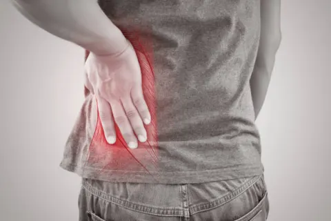 Gout làm suy giảm chức năng thận ở người trẻ.