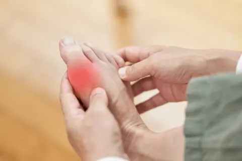 Top 5 nguyên nhân gây đau ngón chân cái có thể bạn chưa biết! 