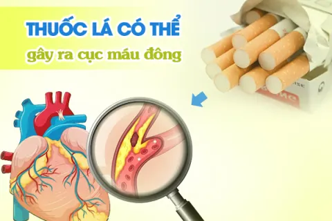 Thuốc lá có thể gây ra cục máu đông.