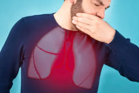 Tìm hiểu: Nguyên nhân gây bệnh viêm phế quản và cách điều trị