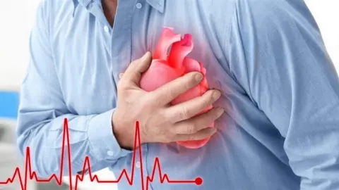 Bệnh mạch vành có thể dẫn đến nhồi máu cơ tim