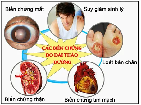 5 bộ phận bị ảnh hưởng nhiều nhất khi mắc bệnh tiểu đường 