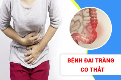 5 Thói quen tốt cho đường ruột của người bệnh đại tràng co thắt vào buổi sáng