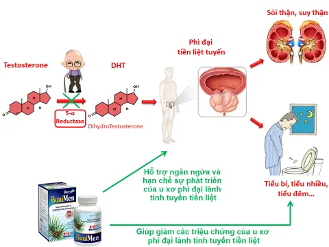 Công dụng của BoniMen