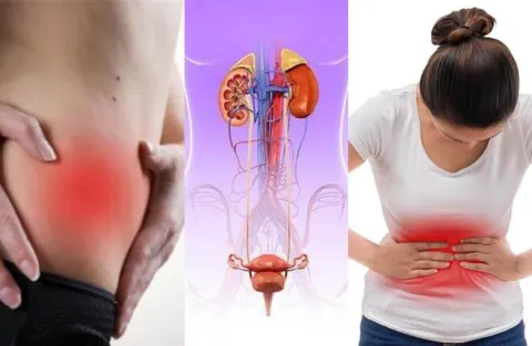 Nữ giới thấy khó chịu trên xương mu, nam giới thấy đầy ở trực tràng.
