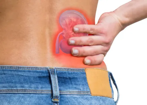 Tại sao bệnh phì đại tuyến tiền liệt gây biến chứng suy thận?