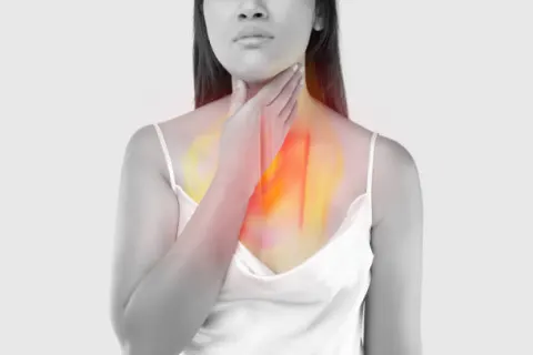 Trào ngược dạ dày thực quản là một nguyên nhân dẫn đến đầy bụng, buồn nôn