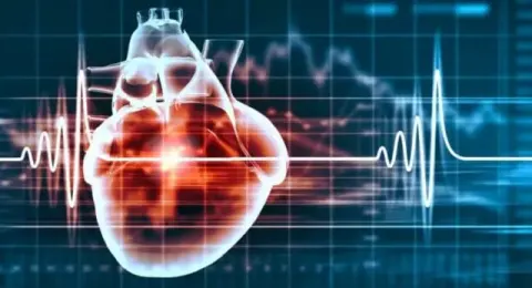 Rối loạn nhịp tim - Mối nguy hại khôn lường nhưng chẳng mấy ai để tâm