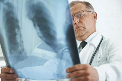 Tôi mới biết mình bị viêm phế quản mãn tính, tôi không muốn dùng thuốc tây mà chỉ uống BoniDetox được không?