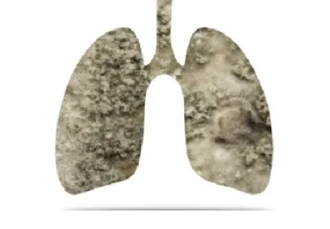 Phổi bị nhiễm độc là nguyên nhân trực tiếp dẫn đến COPD